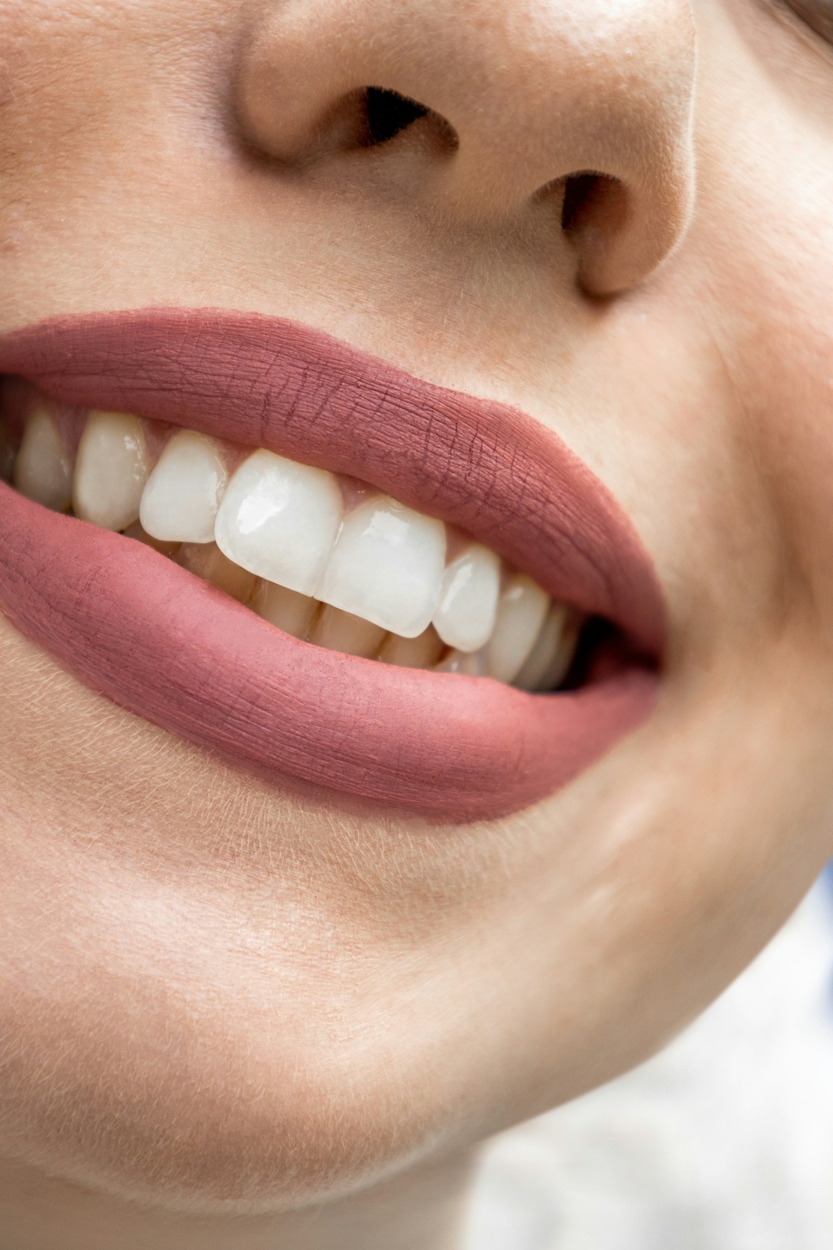 Beautiful smile after teeth whitening